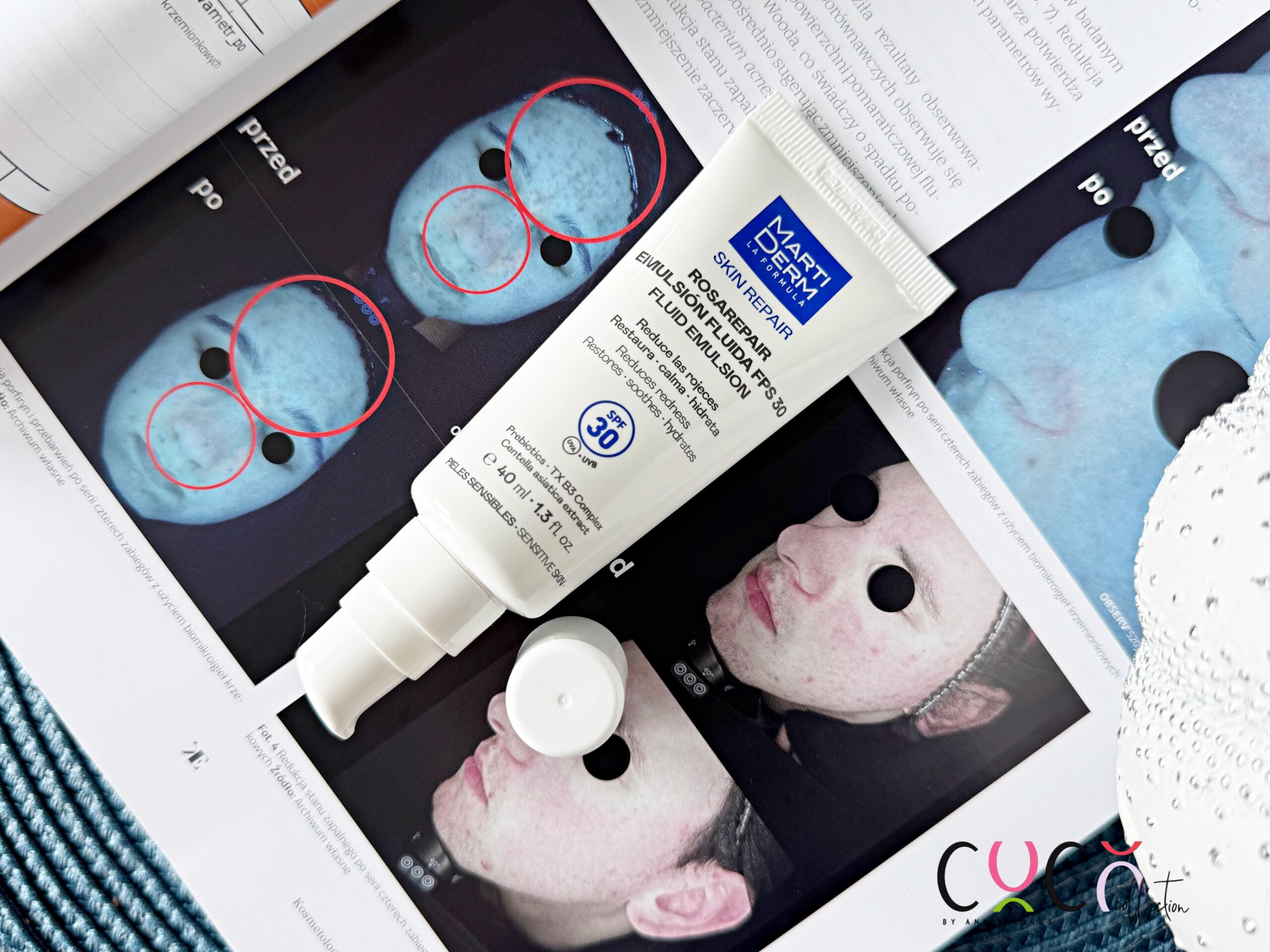 Martiderm Rosarepair COCO COLLECTION blog